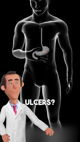 What are stomach ulcers? follow Dr. Pickle for MORE ‼️ #doctor #health