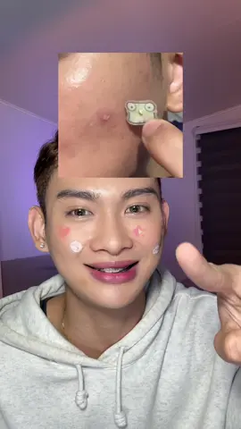 the new designs of these pimple patches from @Posh Skincare Patches are soooo cuteeeee! 😭🩶 #poshskin #poshskinpimplepatches #poshpatches #pimplepatches #pimplepatch #stevenhitosis #BeautyTok #skintok 