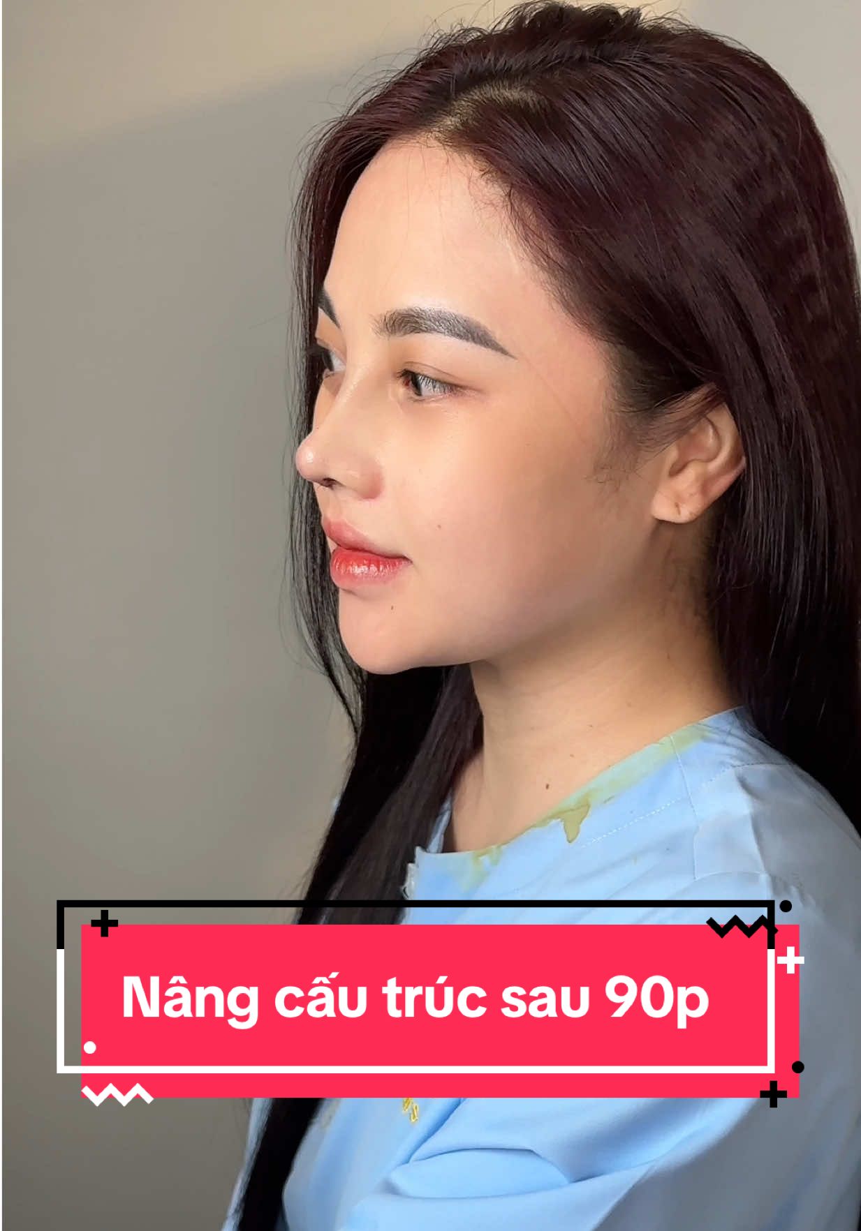 tất nhiên là các bà sẽ muốn đẹppp hơn đúng không#vienthammysone #dangmuidep #ilovetiktok #lamdep #phaidepngaynay #phaidepngaynay #dangmuisline 