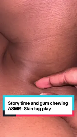 #asmr #asmrsounds #asmrvideo #asmrtiktoks #asmrfood #asmrgumchewing #hairlice #hair #hairstyle #mouthsounds #asmtriggers #chewinggum #hairtok #haircut #asmrmouthsounds #asmrtingles #asmtriggers #dandruff #scratchingasmr 