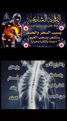 #رقية_شرعية_قوية_جدآ_لفك_العقد_ #والعيون_👁_ولإبطال_أسحار_بأمر  الله ☝️
