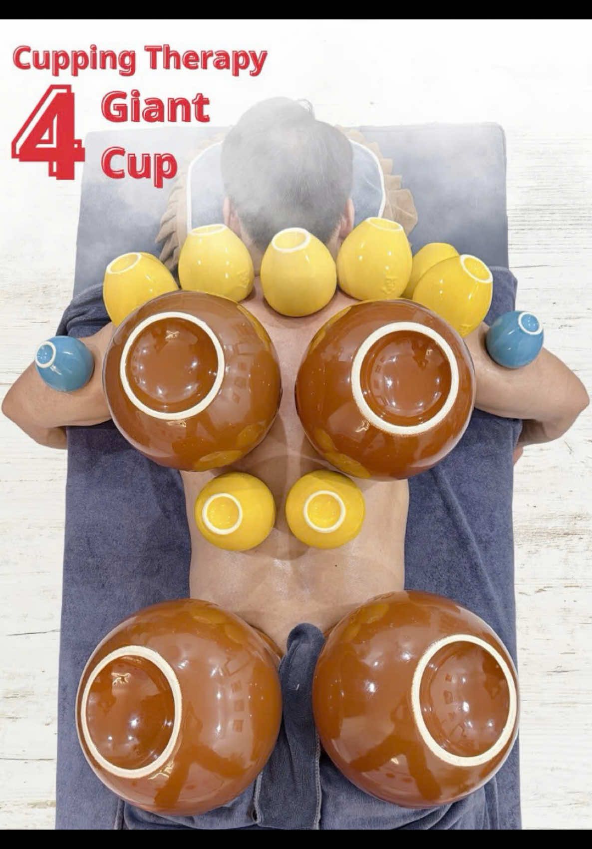 [ASMR] 拔罐 Cupping Therapy with 4 Giant Cup  #asmr #cuppingtherapy #massage #tbodyreset #xuhuong 