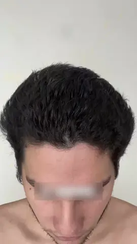 No more hair loss and unconfident with FEG #fegplus #hair #serum #fyp #arab #saudi