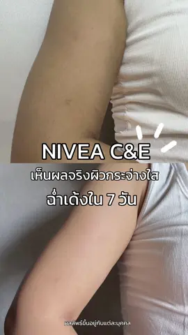 เปลี่ยนผิวหมองคล้ำไม่สดใส ให้สวยไบรท์ ใสฉ่ำเด้ง จนคนทักด้วย NIVEA C&E 💙  #โลชั่นผิวขาว #รีวิวบิวตี้ #ไวท์เทนนิ่ง #tiktokป้ายยา