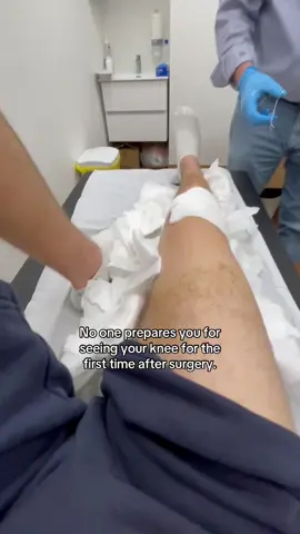 Such a weird feeling. #fyp #injury #relatable #injuryrecovery #meniscus 