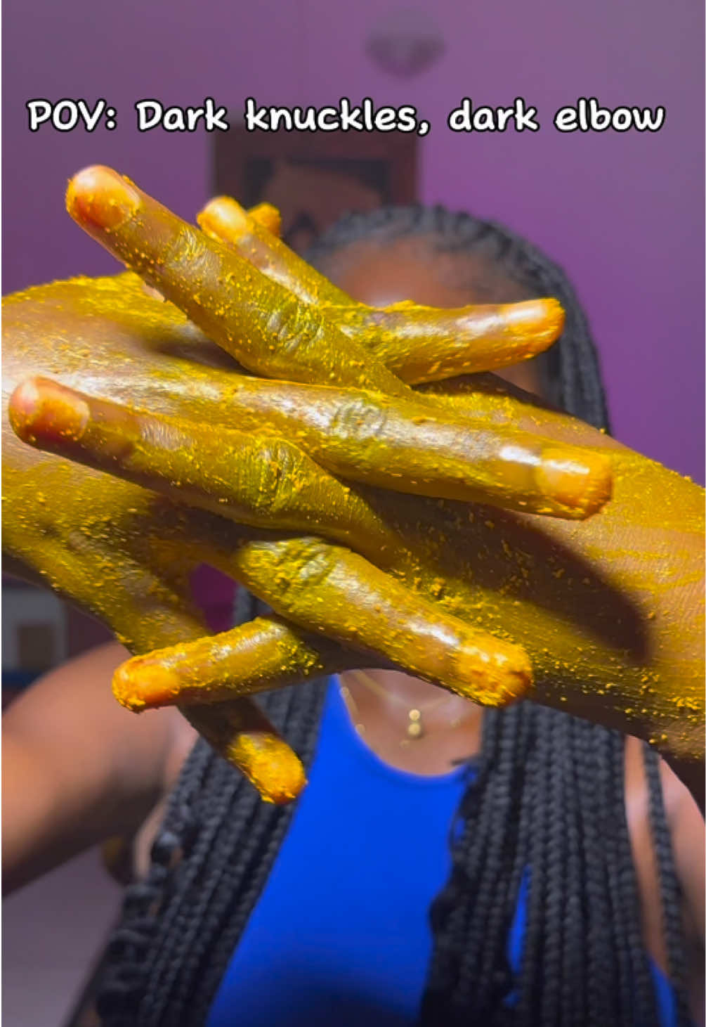 DIY remedy for dark knuckles, dark elbows and knee, dark under arm.  Tumeric + lemon + Vaseline  #DIY #diybeauty #darkknuckles #darkelbows #darkunderarms #fyp #vaseline 