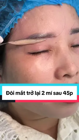 Nâng cung chân mày giấu chỉ 4D giúp đôi mắt trở lại 2 mí #nangcungchanmayrutchi #nangcungchanmay #nangcung #nangcungmay #nangcunggiauchi #xuhuongtiktok #ilovetiktok 