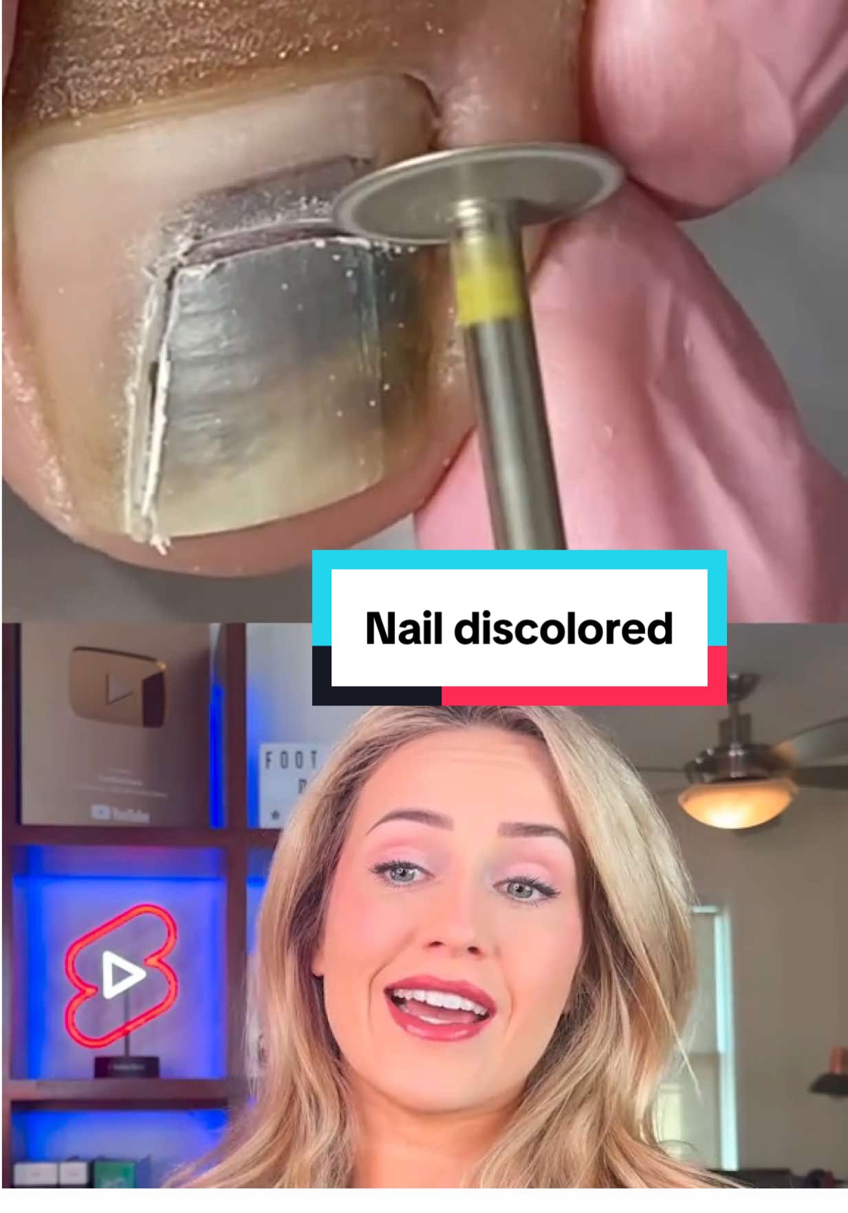 can you watch until the end?!  #bloodblister #toenail #doctor #podiatry