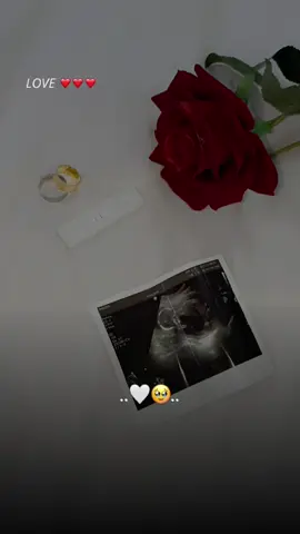 #CapCut  #كلبي_امل_من_صرت 🤰❤ #الشعب_الصيني_ماله_حل😂😂 