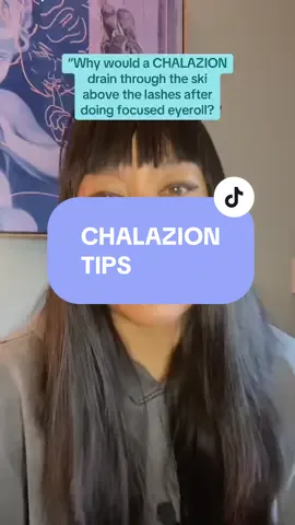 Chalazion tips 💕