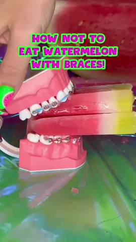 What's your favorite way to eat WATERMELON? 🍉 #braces #watermelon #Summer #crunchy #foeyoupage 