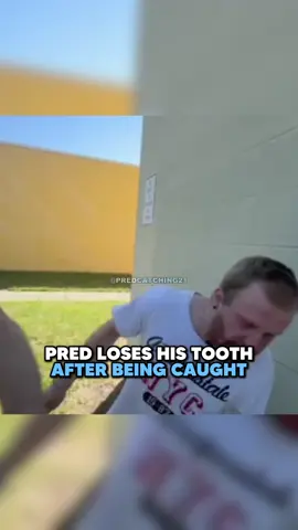 Bro knocked his tooth💀💀😂