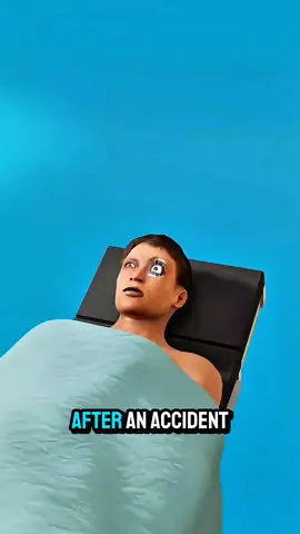 What Happens After Eye Removal Surgery 🤔 #fypシ゚viralシfypシ゚ #viralreelsシ #information #viral #info 