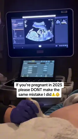 Calling all parents 🥹 #pregnant #pregnancy #ultrasound 