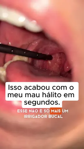 Chega de mau hálito  #mauhalito #fiodental #higienebucal #escovarosdentes 