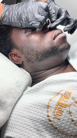 Customized facial with microdermabrasion added  #nycfacials #customfacial #customizedfacial #nyctiktok #menscare #brooklynmensfacial 