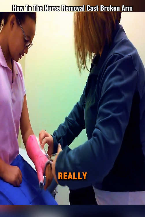 How To The Nurse Removal Cast Broken Arm 😱 #removal #castremoval #cutting #castoff #brokenarm #fyp #emotional #doctorstrange #patientcare #hospital #nursesoftiktok 