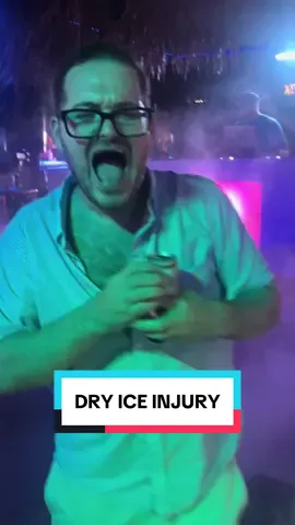 I got burnt by dry ice… happy summer 😂 #summervibes 