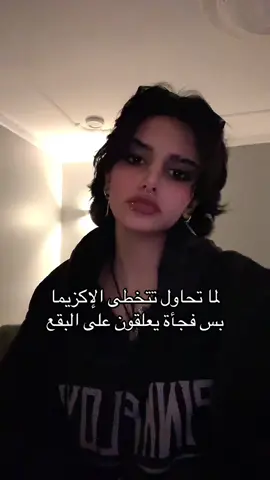 يضايق #alkhobar #fypシ゚viral #foryoupage #اكزيما 