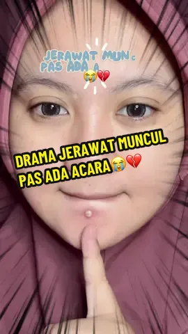 penolong banget klo jerawat udah mendadak muncul kayak gini😭🥹❤️ @Dr.Leo Skincare Indonesia #drleoid #drleoacneessence #acneessence #skincareindonesia 