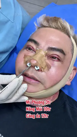 #nangmui #nangmuicautruc ##bacsilamdep #catmi #cangdamat #doncam #chuyensuamui ##suamuihong #bacsinangmuidep #doncam #tiemfiler #cangdamini #hutmo #nangnguc #gotham 