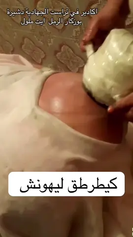 #تراست #اكادير #ايت_ملول #الكديرةالصحراوية #explore #explorer #اكسبلور #اكسبلوررررر#مالي_خلق_احط_هاشتاقات #اكادير_تيزنيت_تافروت_إمازيغن #اكاديريااااات #مغربيةوافتخر #الكديرة_الصحراوية #تكبير_المؤخره_الارداف_تبيض_الجسم #plasticsurgery #هرمونات #تكبير_الارداف #الخفسة #زيادة_الوزن_بطريقة_صحية #marocaine🇲🇦 #maroco🇲🇦algeria🇩🇿tunisia🇹🇳 