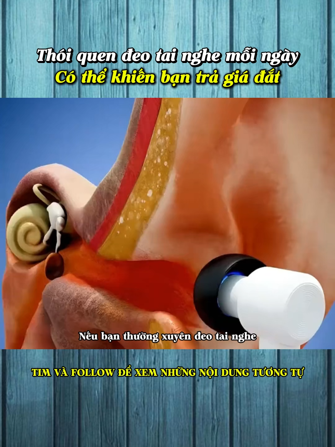 Thói quen đeo tai nghe mỗi ngày có thể khiến bạn trả giá đắt#LearnOnTikTok #khampha #kienthucthuvi #kienthuc #xh #khoahoc #giaitri
