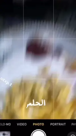 بين الحلم والواقع 🥲😄 #مشاهير_تيك_توك #اكسبلورexplore #اكسبلور #ترند 