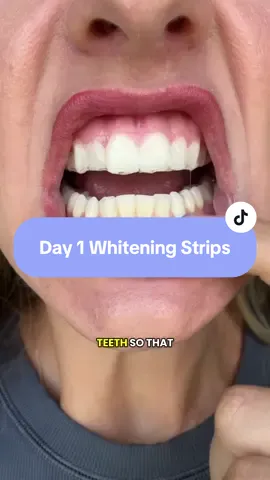 Come back tomorrow to see day 2’s results with the gurunanda whitening strips! #gurunandawhiteningstrips #gurunanda #teethwhitening #whiteningstrips #dealsforyoudays #tiktokshopcreatorpicks 