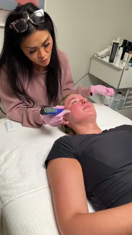 same time next month?!! ❤️‍🔥❤️‍🔥❤️‍🔥 @Artisan Beauté @getroeme #artisanbeauteatlantapartner #roemeconnect #microneedling #acnescartreatment #plasticsurgery 