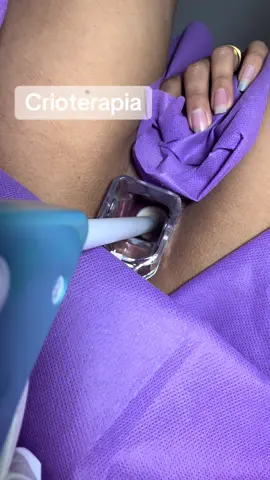 ¿𝗧𝗲 𝗱𝗲𝘁𝗲𝗰𝘁𝗮𝗿𝗼𝗻 𝘂𝗻𝗮 𝗹𝗲𝘀𝗶𝗼́𝗻 𝗰𝗲𝗿𝘃𝗶𝗰𝗮𝗹? 💥  ¡No te asustes! La crioterapia puede ser tu gran aliada 💪💙. Es un tratamiento que utiliza frío extremo para eliminar las células anormales del cuello uterino causadas por infecciones como el VPH. Está indicado en casos de displasias cervicales leves o moderadas, lesiones provocadas por el virus del papiloma humano y ectropión cervical. ❄️👩‍⚕️ La crioterapia ofrece múltiples beneficios: ✅ ayuda a prevenir el cáncer de cuello uterino, es un procedimiento ambulatorio y no necesitas descanso médico. ¡Recuperación rápida y segura! 💃 ✨ En 𝗠𝘂𝗷𝗲𝗿 𝗘𝗺𝗽𝗼𝗱𝗲𝗿𝗮𝗱𝗮 - 𝗦𝗲𝗿𝘃𝗶𝗰𝗶𝗼𝘀 𝗠𝗲́𝗱𝗶𝗰𝗼𝘀 𝘆 𝗚𝗶𝗻𝗲𝗰𝗼 𝗘𝘀𝘁𝗲́𝘁𝗶𝗰𝗮 cuidamos tu salud íntima con tratamientos efectivos y confiables.  💗 ¡𝗥𝗲𝘀𝗲𝗿𝘃𝗮 𝘁𝘂 𝗰𝗶𝘁𝗮 𝗮𝗵𝗼𝗿𝗮! --------------------- 📞𝗔𝗴𝗲𝗻𝗱𝗮 𝘁𝘂 𝗰𝗶𝘁𝗮 𝗮𝗹: 📲945 102 921 . . #PrevenciónEsSalud #MujerEmpoderada #SaludFemenina #GinecoEstética #VPH #CrioterapiaCervical
