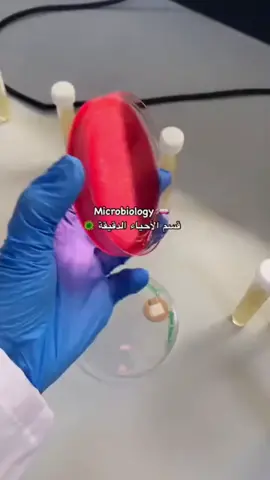 #الاحياء_الدقيقه🔬🧬 #microbiology  #البكتيريا #مختبرات #تحاليل_طبية  #مختبر_السلام_الكفرة🩸🤍🧬