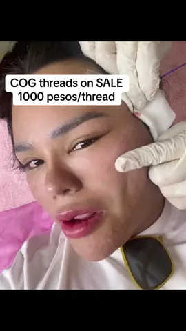 Cog thread lift by Doc JC #foryou #foryoupage 