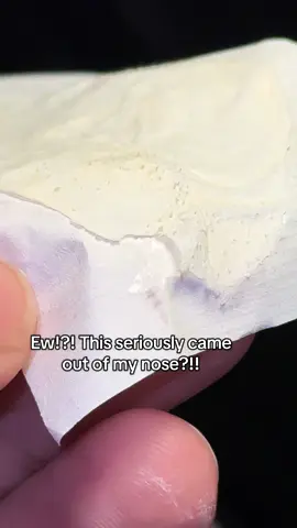 INSANE and so embarrassing🙃 safe to say this blackhead remover TRULY works! Buy yours now while it's still on sale, this is a stealllll👏🏽 #labena #porestrips #mask #blackheads #remover #SelfCare #Dealsforyoudays 