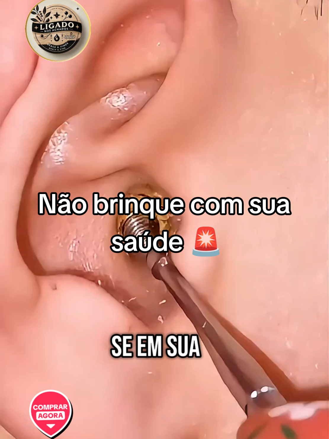 Diga adeus aos cotonetes descartáveis! Esse kit de limpeza de ouvido com 6 peças em aço inox é durável, higiênico e super eficiente! Com estojo compacto e design ergonômico, remove a cera com segurança e ainda alivia a coceira no canal auditivo. 👉 Ideal pra quem valoriza organização, praticidade e bem-estar no dia a dia! #limpezadeouvido  #higienepessoal  #cuidadoscomasaude  #ucgcreator #compras 