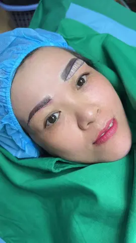 Treo cung mày 