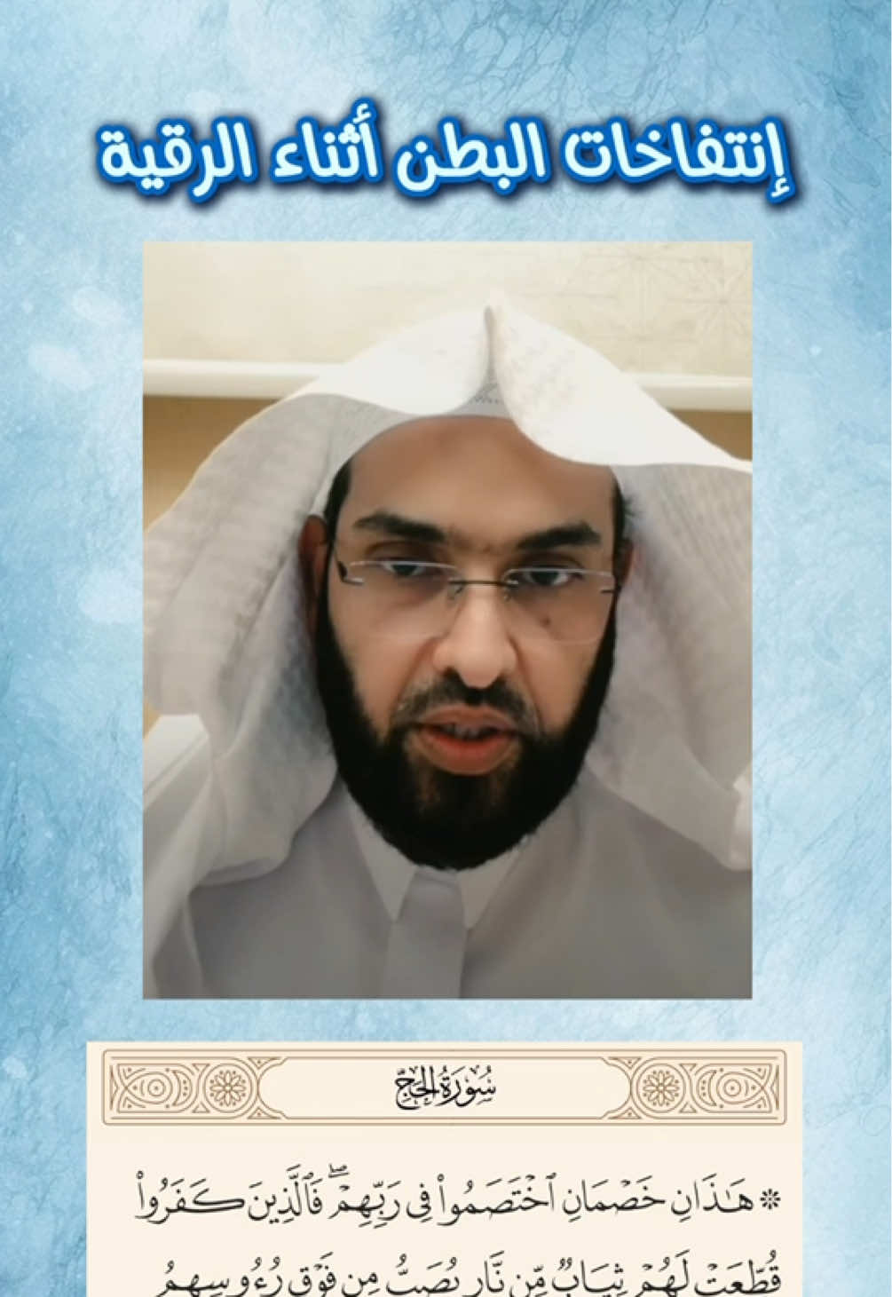 انتفاخ البطن أثناء الرقية #فارس_التفسير #الرقية_الشرعية #الدال_على_الخير_كفاعله_🤲🌷 #السعودية_الكويت_الإمارات_عمان_البحرين_العراق_سوريا_لبنان_اليمن 