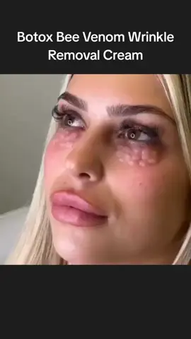 Botox without the needle!!! Tired of trying everything for your skin? #SkincareRoutine #GlowingSkin #NaturalSkincare #AntiAging #CleanBeauty   #ViralSkincare #Niacinamide #HyaluronicAcid #BotoxAlternative #SkincareTikTok   #BeforeAndAfter #SkincareResults #BeautyTips #FaceCream #tiktokmademebuyit 