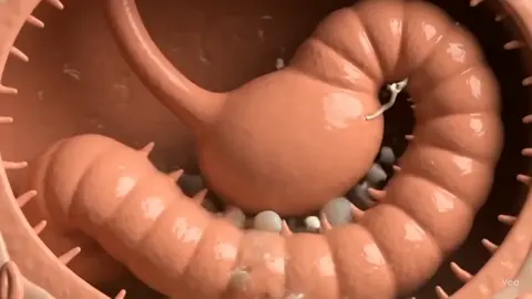 tapeworm survive in human body #tapeworm #human #babygirl 