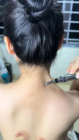 Bút xung điện trị liệu mmassage  Giảm đau mỏi cơ xương khớp, lưu thông khí huyết  #butxungdientrilieu #butxungdienchamcuu #butxungdiendohuyet #xuhuong 