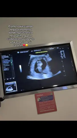 Lo esperamos todos con ansias.🫶🏻#fyp #miprimo #conmitiaembarazada👶👶 #tequiero @Ｐ Ａ Ｔ Ｙ🍓 