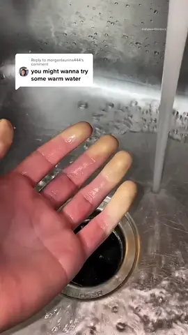Strange Color Change in Fingers‼️😱 #usa #amazing #factsonly #thedesighisveryhuman #usafacts #funfacts 