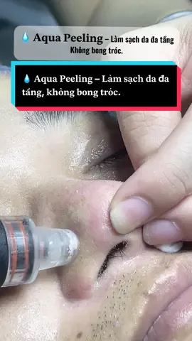 Aqua Peeling là liệu trình làm sạch sâu, sử dụng lực hút xoắn nước kết hợp dung dịch Aha/BHA để: • Loại bỏ tế bào chết, mụn đầu đen – đầu trắng • Làm sạch bã nhờn, bụi bẩn sâu trong lỗ chân lông • Cấp ẩm, đưa dưỡng chất vào sâu bên trong da • Hỗ trợ điều tiết dầu, giảm mụn, sáng da đều màu #nanmuntpbacninh #chamsocda #nanmunchuanykhoa #spabacninh #trietlong #noraspa #nanmun #trietlonglanh 