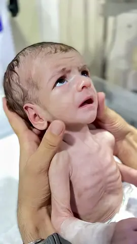 Abubakar Baby is now 70% stable in the NICU, showing strong signs of recovery. From a critical state to visible improvement, this journey is full of prayers, care, and medical support. Mashallah for every little step toward full healing. If you want to donate for saving lives:paypal tayyeb88@yahoo.com  #AbubakarBaby​ #70PercentStable​ #NICUProgress​ #MashallahBaby​ #NICUBaby​ #PrematureCare​ #BabyImprovement​ #NICUUpdate​ #TinyFighter​ #NewbornHealing​ #NICULove​ 