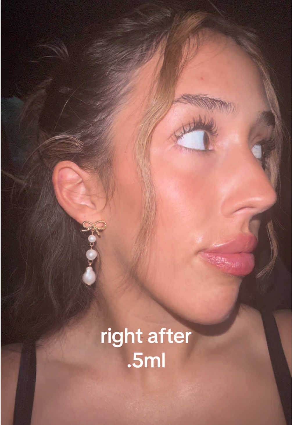 Love this game 👄 #lipfiller 