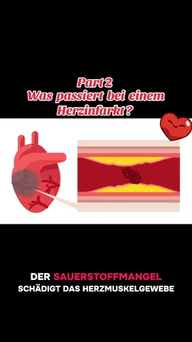 Kennst du die Warnzeichen? Dieses Wissen kann Leben retten. Folge für mehr medizinische Aufklärung! #Gesundheit#wissen#herz