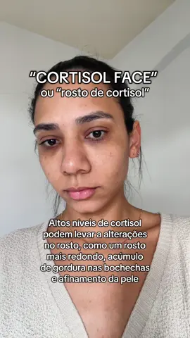 Outra era minhas irmãs 🌝✨ #suplementos #cortisol #magnesio #GlowUp #nulle #estresse 