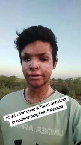 Donate to his care — every bit helps 💔 you are my hero  Link in biography and help me any amount is highly appreciated  #islamic_video #saudiarabia #gaza #subhanallah #alhamdulillah #salam #dubai🇦🇪 #palestine #foryoupage #foryou  #alhamdulillahforeverything #allah #allahuakbar #usa_tiktok #usatiktok 