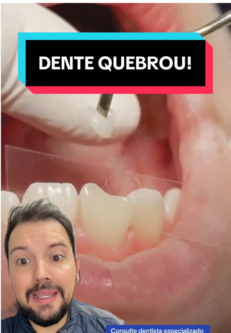 Exatamente! Consultar um dentista especialista é fundamental para receber um tratamento de qualidade e personalizado. Eles podem avaliar a situação dos seus dentes, oferecer diagnósticos precisos e indicar o melhor tratamento, seja para cáries, ortodontia ou qualquer outra necessidade dental. Além disso, um dentista pode ajudar com dicas de prevenção e cuidados diários que são essenciais para manter a saúde bucal em dia.  #dentista #dente #boca #qualidade #odontologia #sorriso #dentequebrado 
