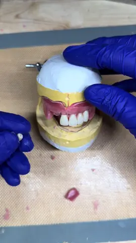 Denture teeth 🦷 #teeth #dental 